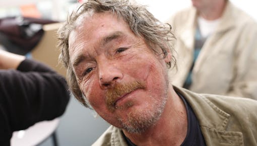 Homelessness